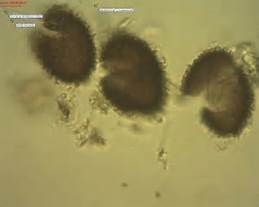spores de melano