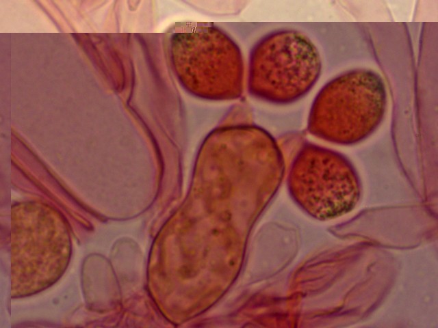 basides avec spores2.jpg