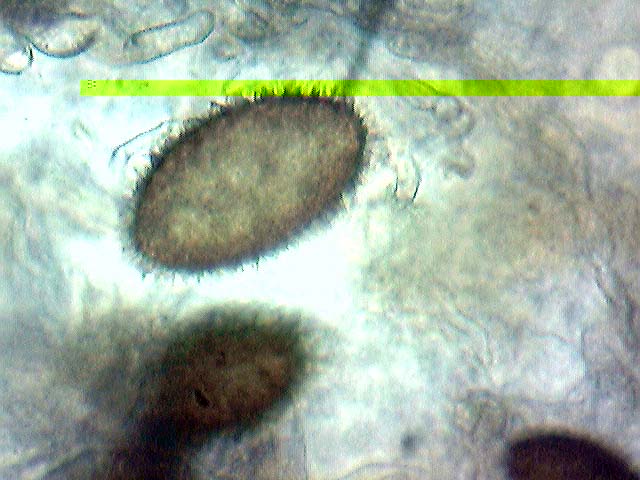 spore individuelle.jpg